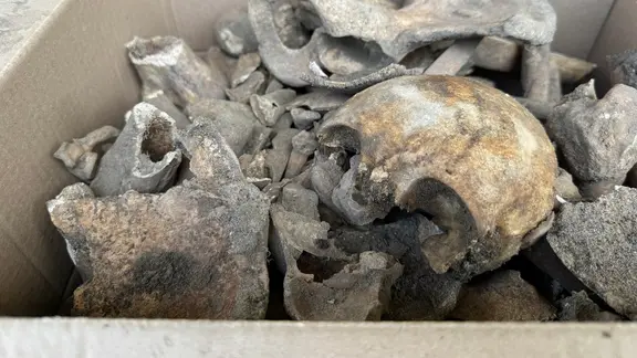 Old bones and part of a skull lie in a box