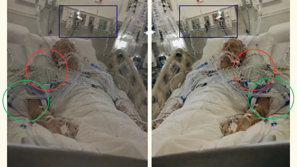 1783919417 434 Fake image of Mitch McConnells hospital spreads as questions surround