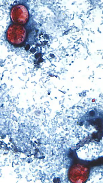 1784638523 196 How the intestinal parasite outbreak unfolded in the United States
