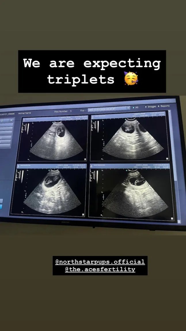 Emmerdale's Lucy Pargeter 'expecting triplets' as she shares big news | Soap 15 Emmerdale's Lucy Pargeter is 'expecting triplets' as she makes surprise announcement