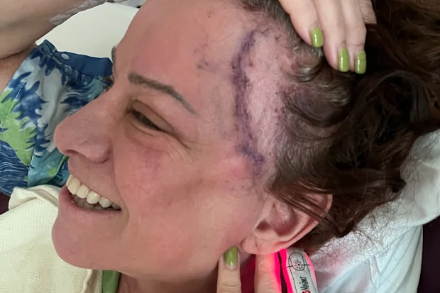 L7 bassist Jennifer Finch has brain cancer