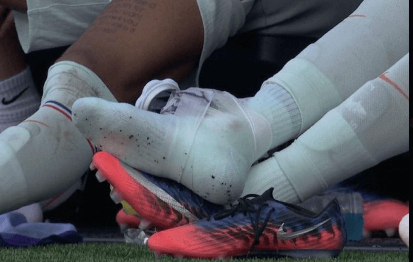 Kylian Mbappe left the France vs Morocco match with an apparent injury 11 Mbappe's leg is encased in ice